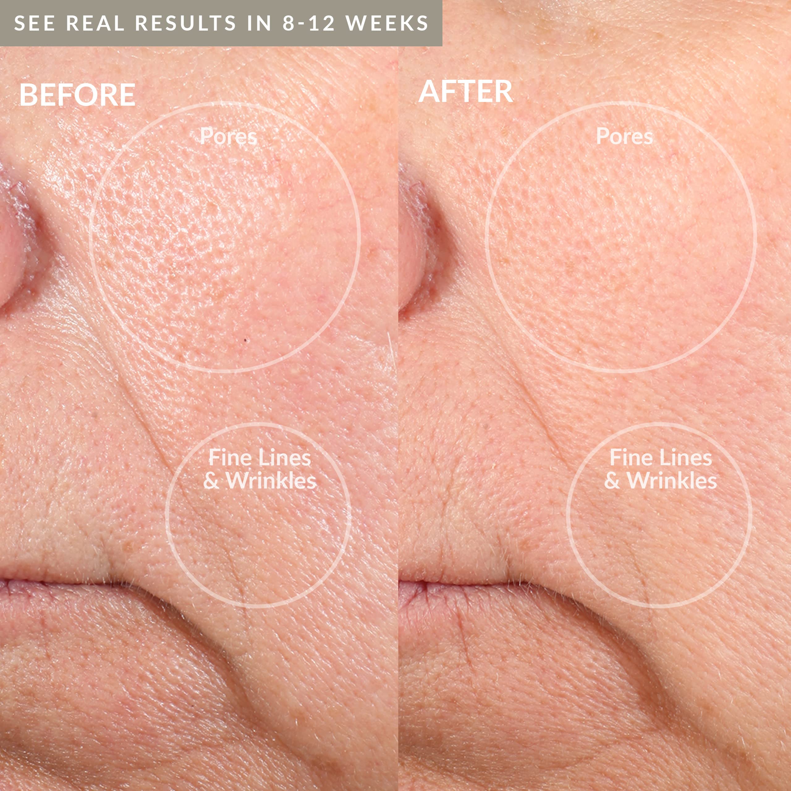 PMD Personal Microderm Pro